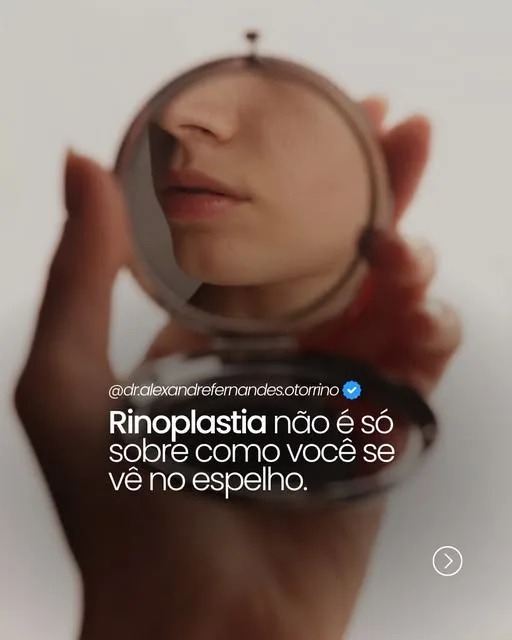 Post do Dr. Alexandre Fernandes no Instagram